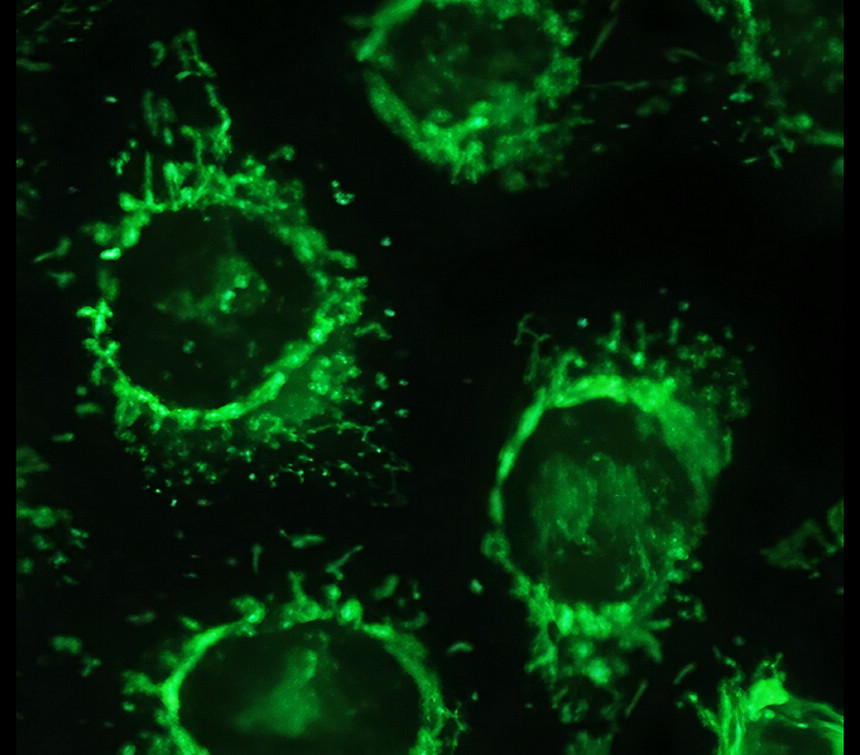 IRM028 Hexokinase II / HK2, monoclonal antibody ICC/IF image IRM028 Hexokinase II / HK2, monoclonal antibody ICC/IF image