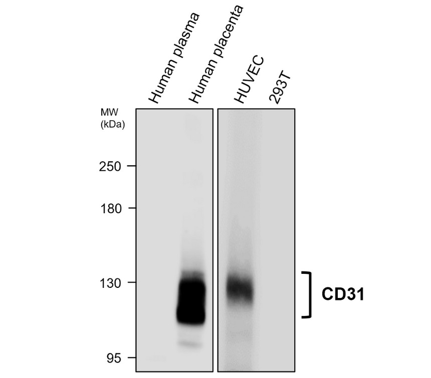 IR75-254 CD31 (human specific) antibody WB image IR75-254 CD31 (human specific) antibody WB image