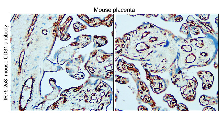 IR75-253 anti-mouse CD31 antibody IHC-P image IR75-253 anti-mouse CD31 antibody IHC-P image