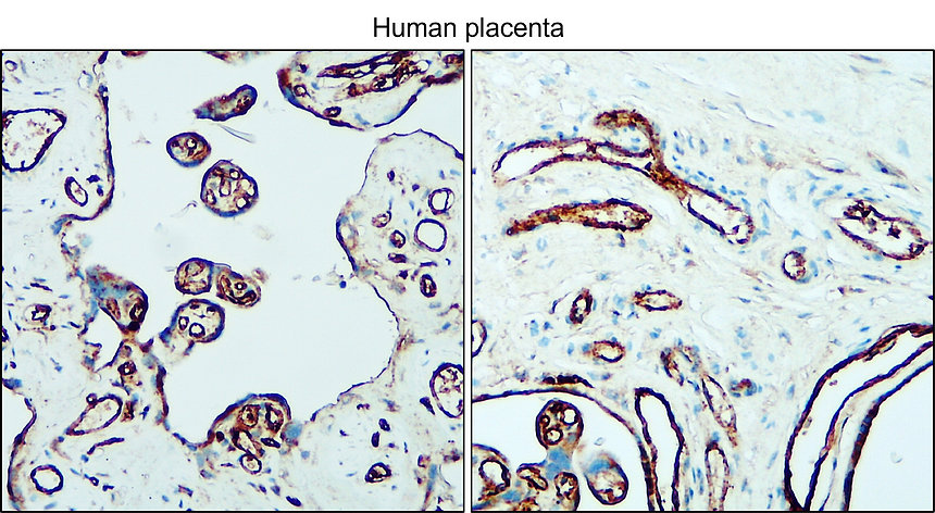 IR75-254 CD31 (human specific) antibody IHC image IR75-254 CD31 (human specific) antibody IHC image
