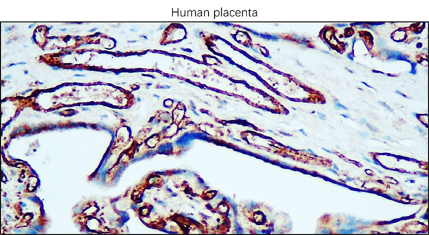IR75-254 CD31 (human specific) antibody IHC image IR75-254 CD31 (human specific) antibody IHC image