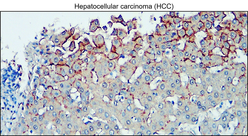 IR80-274 anti VE-Cadherin / CD144 antibody IHC image
