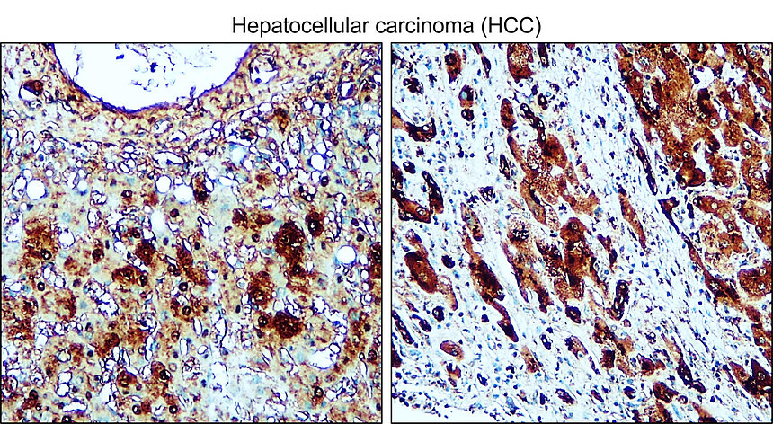 IRCP220803 anti-ALPK2 antibody IHC image