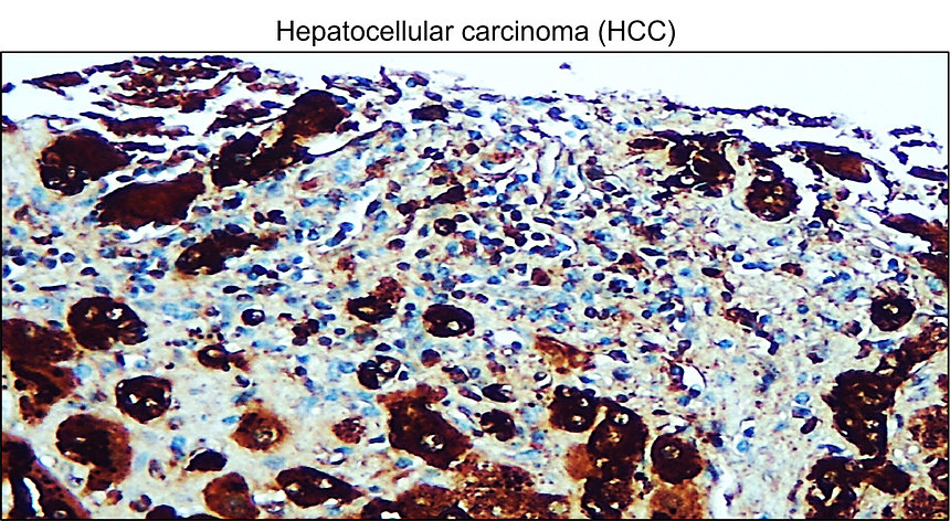IRCP220803 anti-ALPK2 antibody IHC image
