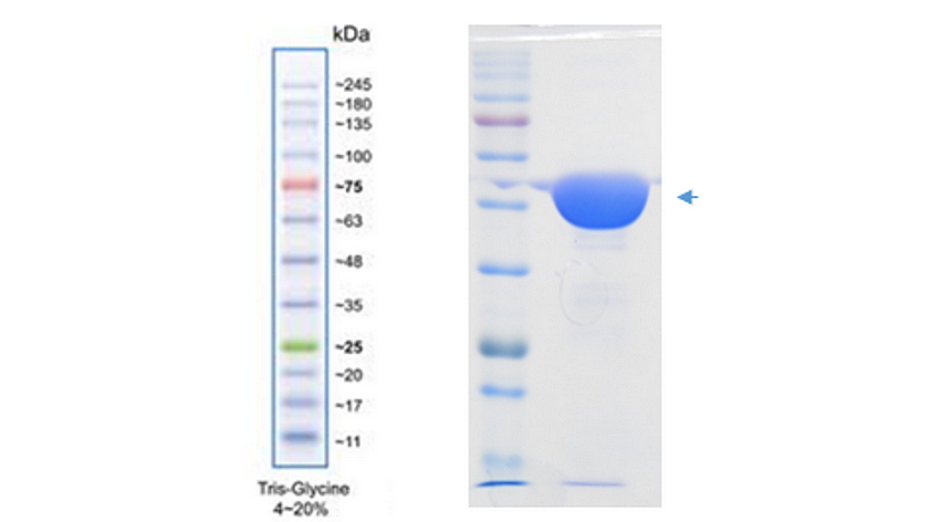 IRRP7006_Enolase-2 / NSE Recombinant Protein, Human IRRP7006_Enolase-2 / NSE Recombinant Protein, Human