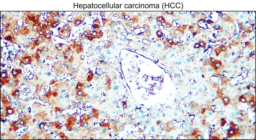 IRM405 AIF / M1monoclonal antibody IHC Image IRM405 AIF / M1monoclonal antibody IHC Image