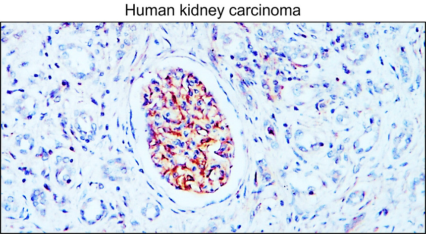 IR8-23 anti-Nestin antibody IHC image IR8-23 anti-Nestin antibody IHC image