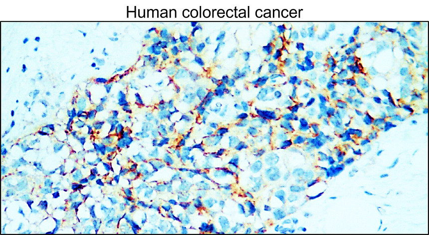 IR55-180 anti-E cadherin antibody IHC image