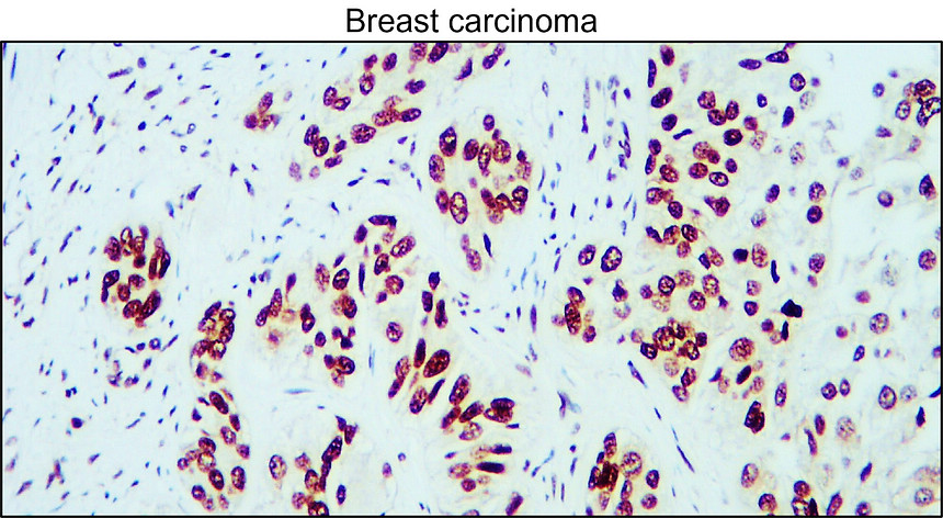 IR116-289 anti-Cyclin B1 antibody IHC image IR116-289 anti-Cyclin B1 antibody IHC image