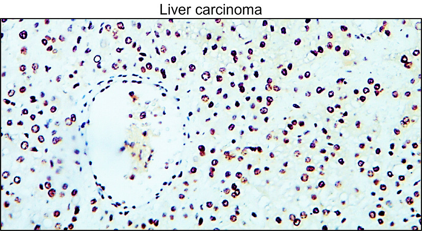 IR116-289 anti-Cyclin B1 antibody IHC image IR116-289 anti-Cyclin B1 antibody IHC image