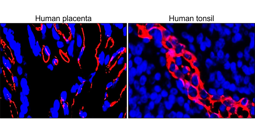 IR75-254 anti-CD31 (human specific) antibody IHC-Fr image IR75-254 anti-CD31 (human specific) antibody IHC-Fr image
