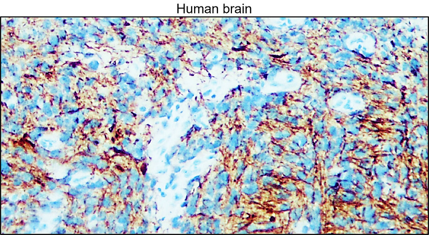 IR31-90 anti- NSE / Enolase-2 antibody IHC image IR31-90 anti- NSE / Enolase-2 antibody IHC image