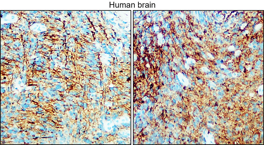 IR31-90 anti- NSE / Enolase-2 antibody IHC image IR31-90 anti- NSE / Enolase-2 antibody IHC image