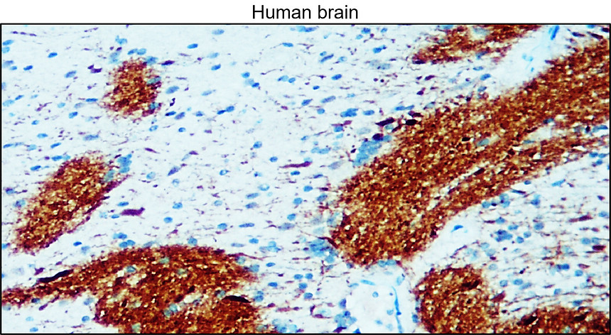 IR31-90 anti- NSE / Enolase-2 antibody IHC image