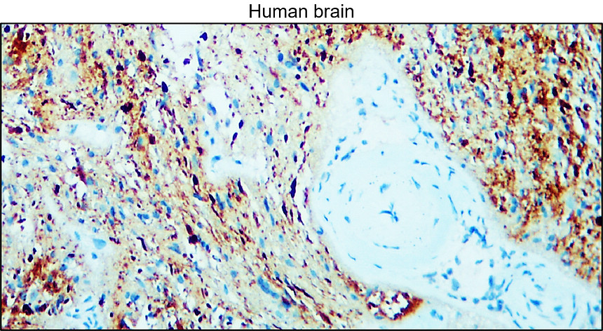 IR31-90 anti- NSE / Enolase-2 antibody IHC image