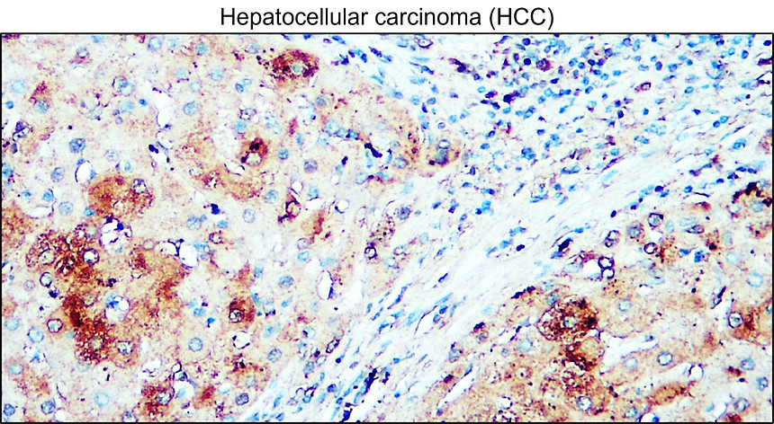 IRM405 AIF / M1monoclonal antibody IHC Image IRM405 AIF / M1monoclonal antibody IHC Image