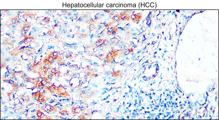 IRM405 AIF / M1monoclonal antibody IHC Image IRM405 AIF / M1monoclonal antibody IHC Image
