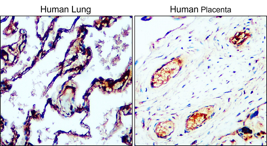 IR81-279 anti-VEGF Receptor 2 antibody IHC image IR81-279 anti-VEGF Receptor 2 antibody IHC image