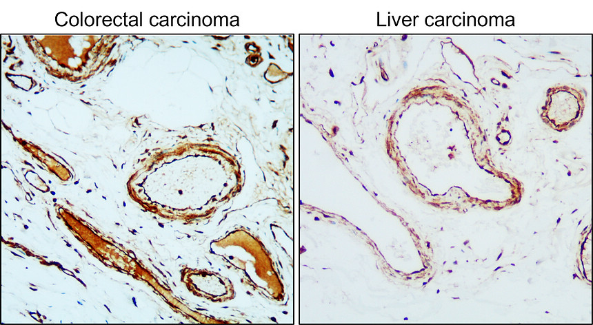 IR81-279 anti-VEGF Receptor 2 antibody IHC image