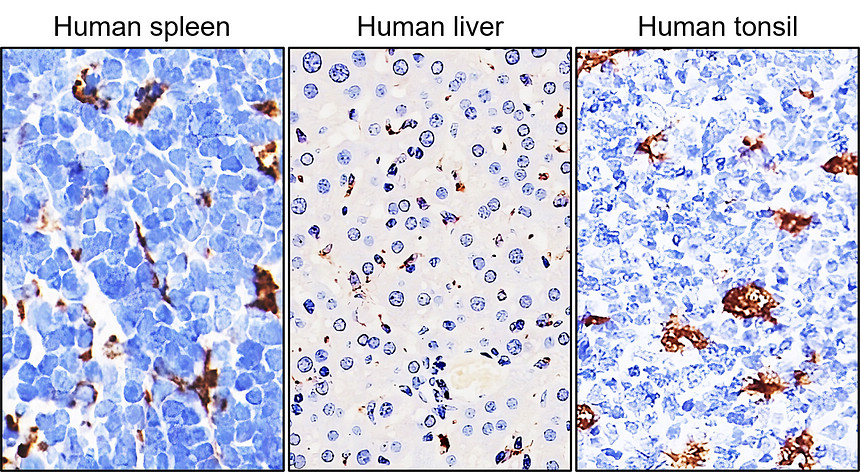 IR29-77 anti-CD68 antibody IHC image IR29-77 anti-CD68 antibody IHC image