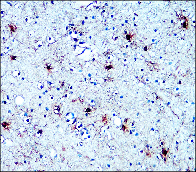 S100B antibody S100B antibody