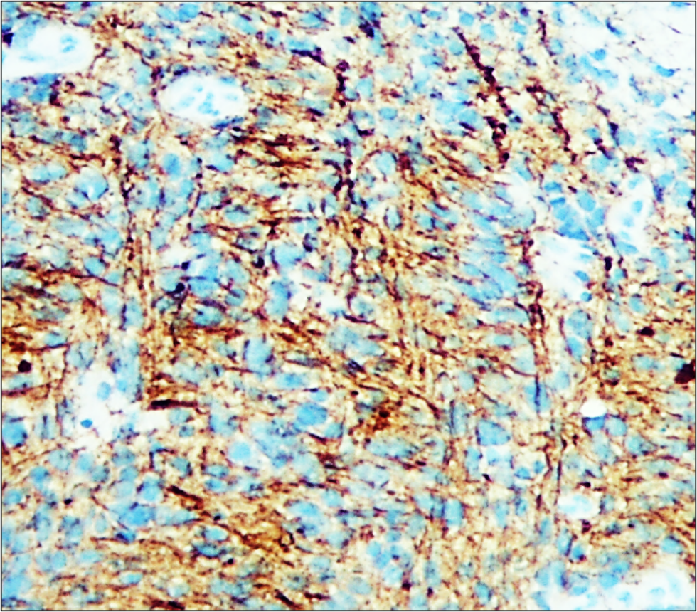 NSE / Enolase-2 antibody NSE / Enolase-2 antibody