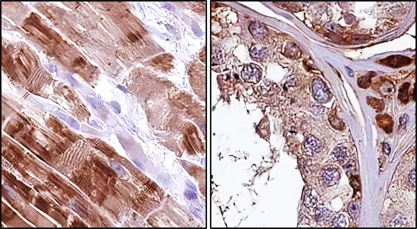 Customer feedback IRCP011 anti FNDC5 / irisin antibody IHC image Customer feedback IRCP011 anti FNDC5 / irisin antibody IHC image