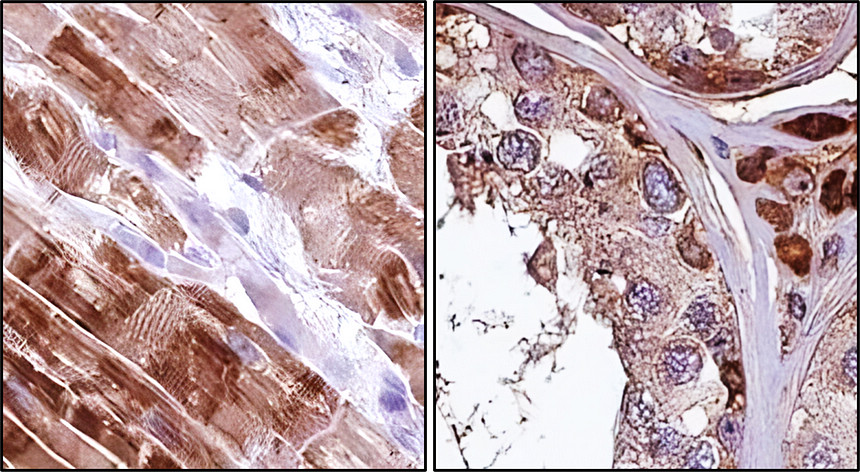 Customer feedback IRCP011 anti FNDC5 / irisin antibody IHC image