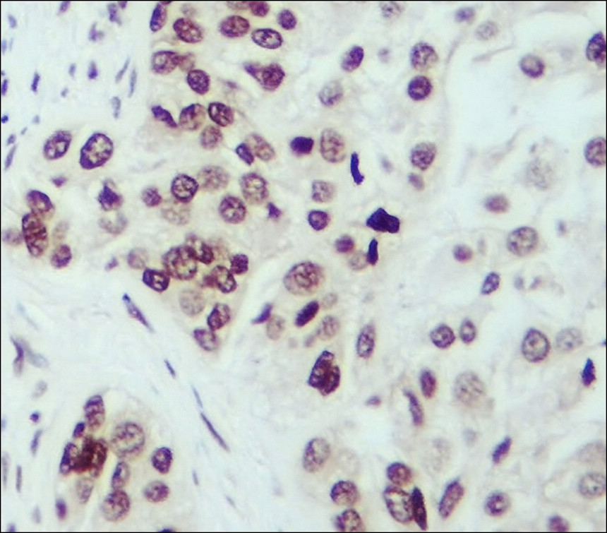 IRCP005 anti-GON4L antibody IHC image