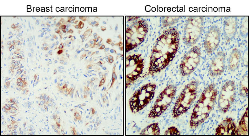 IR238-892 anti-Cytokeratin 20 antibody IHC image IR238-892 anti-Cytokeratin 20 antibody IHC image