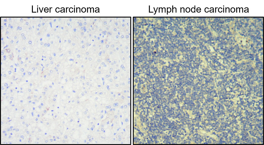 IR238-892 anti-Cytokeratin 20 antibody IHC image IR238-892 anti-Cytokeratin 20 antibody IHC image