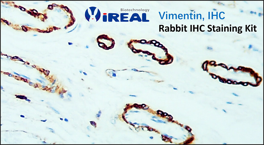 Vimentin IHC,  Rabbit IHC Staining Kit