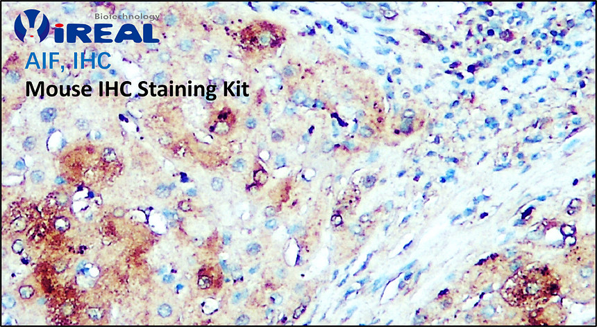 AIF IHC, Mouse IHC Staining Kit