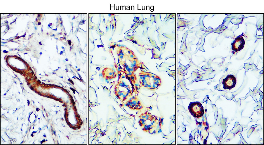 IR112-462 anti-TGF beta 1 antibody IHC image IR112-462 anti-TGF beta 1 antibody IHC image