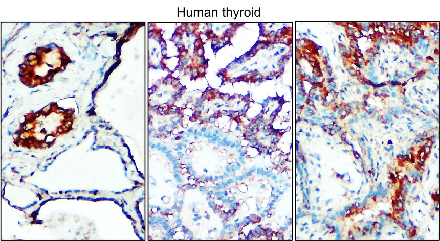 IR112-462 anti-TGF beta 1 antibody IHC image IR112-462 anti-TGF beta 1 antibody IHC image