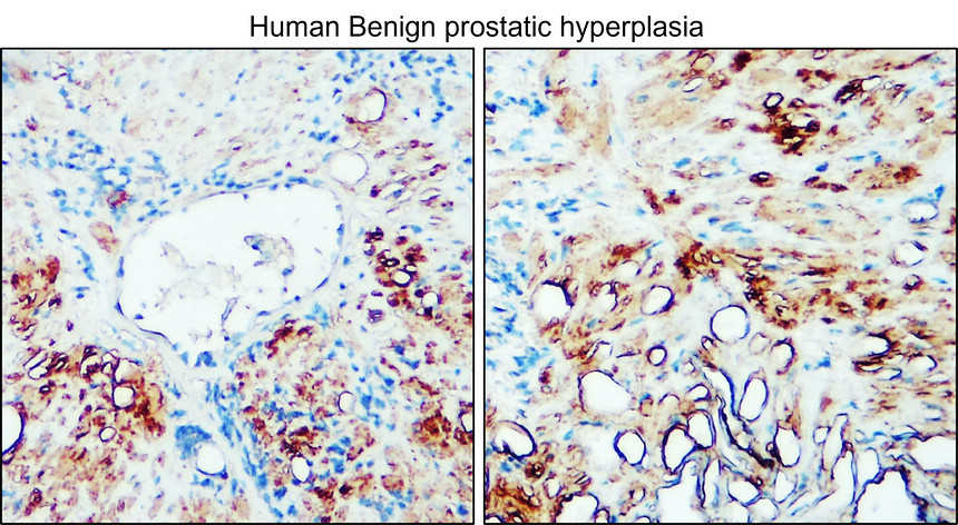 IR112-462 anti-TGF beta 1 antibody IHC image