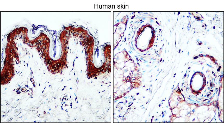 IR112-462 anti-TGF beta 1 antibody IHC image