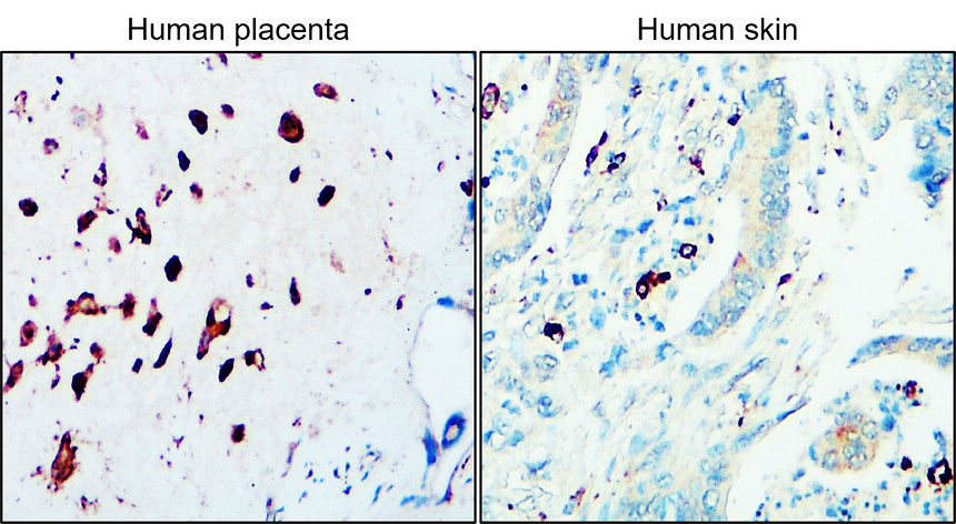 IR29-77 anti-CD68 antibody IHC image IR29-77 anti-CD68 antibody IHC image