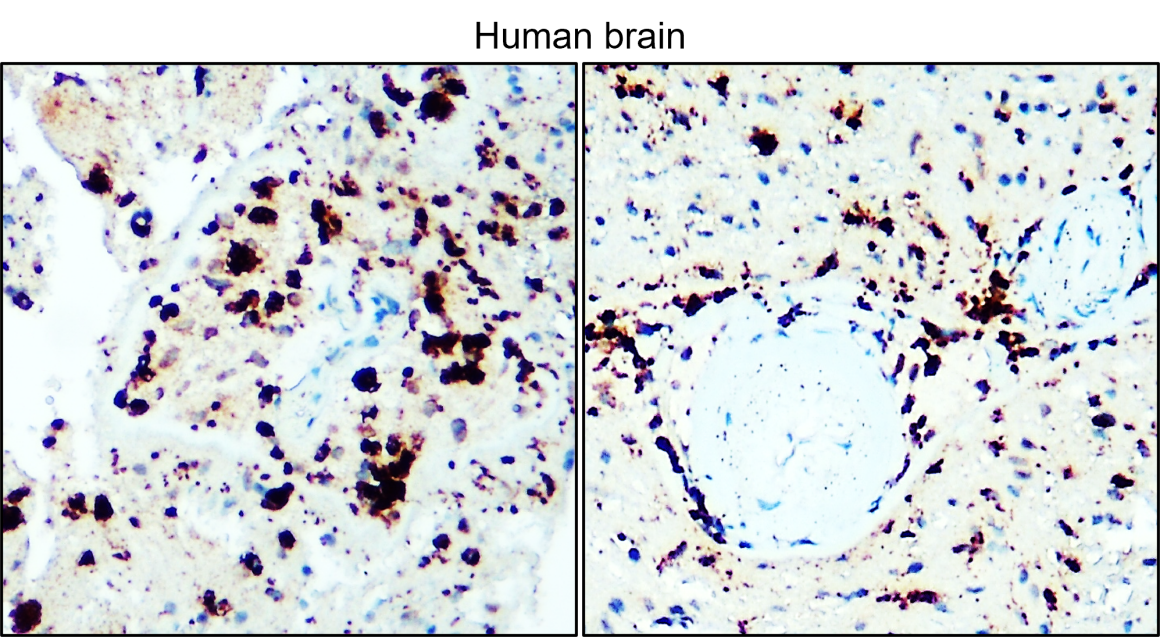 IR29-77 anti-CD68 antibody IHC image IR29-77 anti-CD68 antibody IHC image