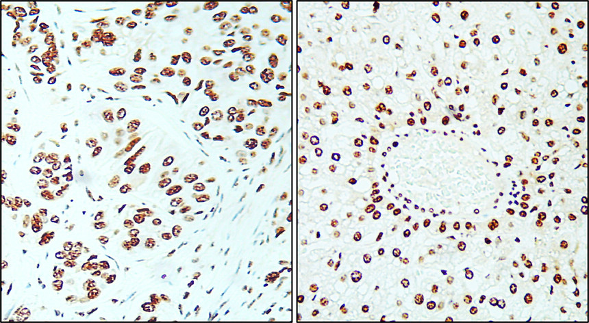 IR212-772 anti- Ki-67 antibody IHC image IR212-772 anti- Ki-67 antibody IHC image