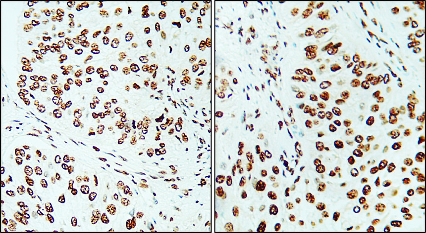 IR212-772 anti- Ki-67 antibody IHC image IR212-772 anti- Ki-67 antibody IHC image