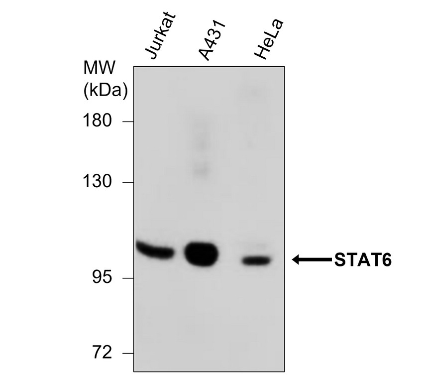 IRM032 STAT6, monoclonal antibody WB image IRM032 STAT6, monoclonal antibody WB image