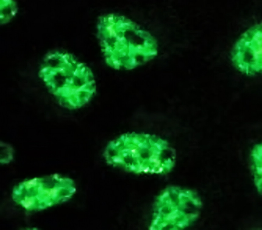 IRM032 STAT6, monoclonal antibody ICC/IF image IRM032 STAT6, monoclonal antibody ICC/IF image