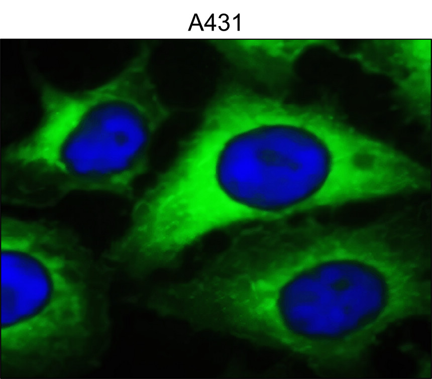 IRM033 NF-kB p65, monoclonal  antibody ICC/IF image