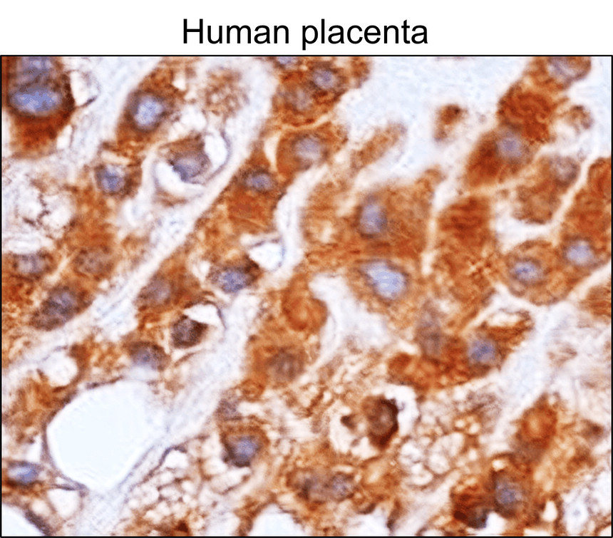 IRM033 NF-kB p65, monoclonal  antibody IHC image 
