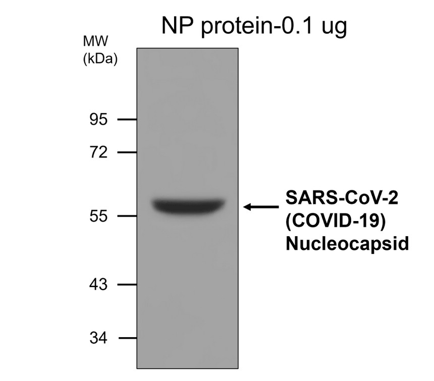 IRM036 SARS-CoV-2 nucleocapsid protein, monoclonal [6C2D]