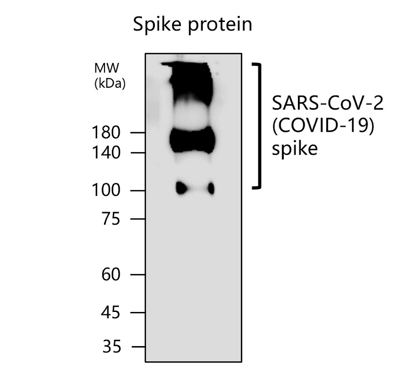 IRPA2302 anti-SARS-CoV-2 (COVID-19) Spike Protein S1-NTD antibody WB image IRPA2302 anti-SARS-CoV-2 (COVID-19) Spike Protein S1-NTD antibody WB image