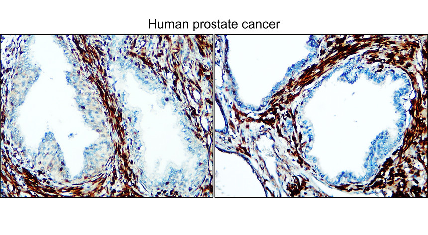 IR31-90 anti- NSE / Enolase-2 antibody IHC image