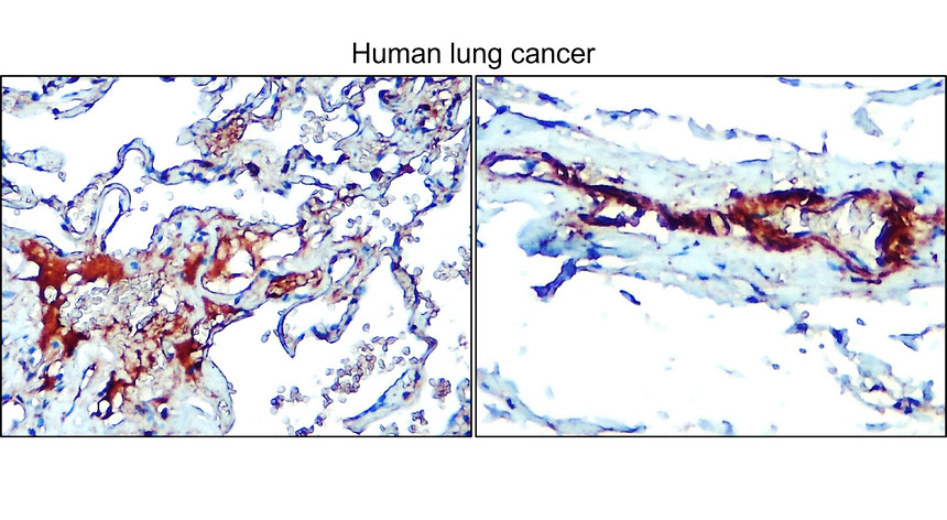 IR31-90 anti- NSE / Enolase-2 antibody IHC image