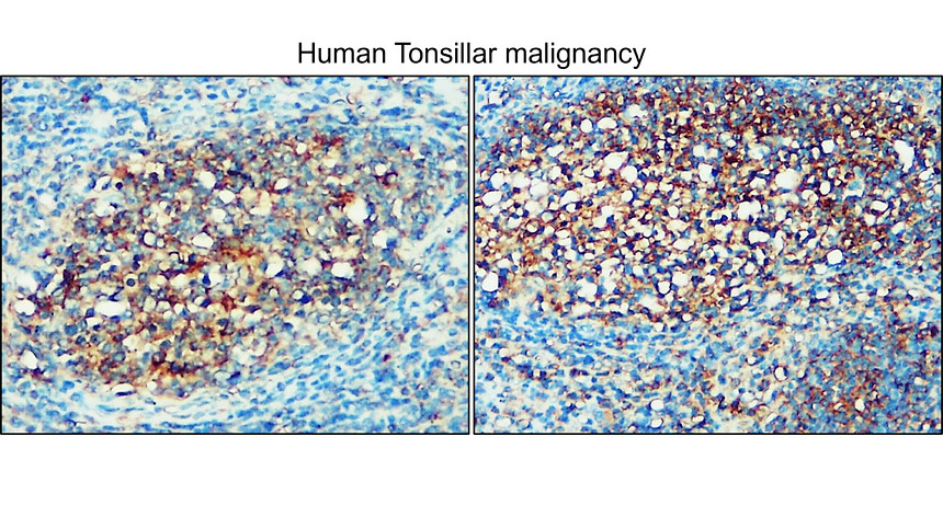 IR31-90 anti- NSE / Enolase-2 antibody IHC image